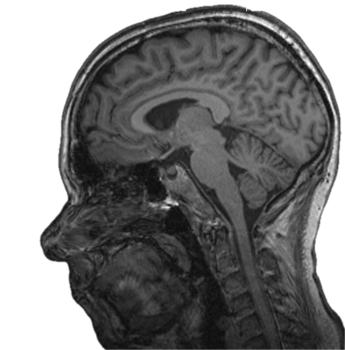 MRT des Gehirns von Christoph Helfenbein